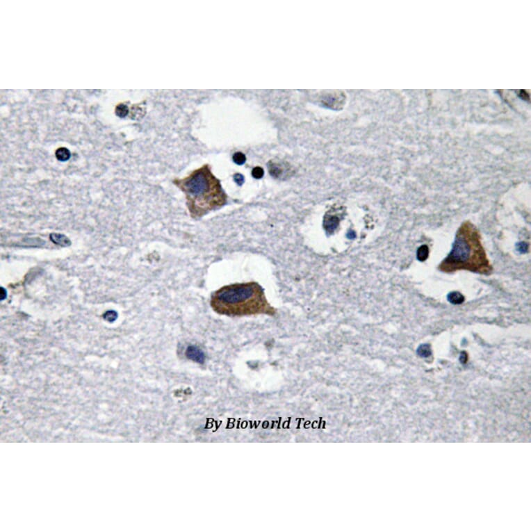 Anti-SDF-1 (M93) Antibody from Bioworld Technology (BS3512) - Antibodies.com