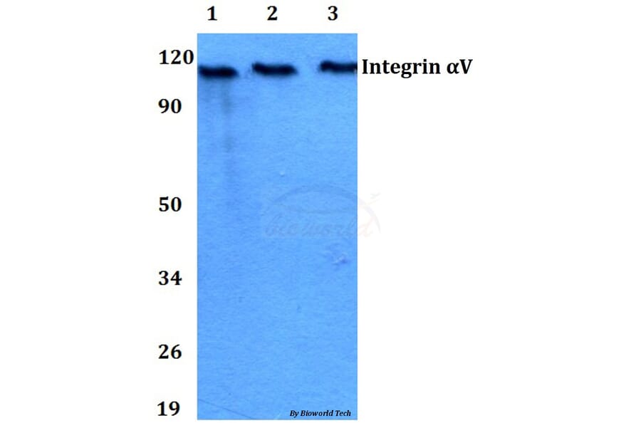Anti-Integrin αV (P804) Antibody from Bioworld Technology (BS3513) - Antibodies.com