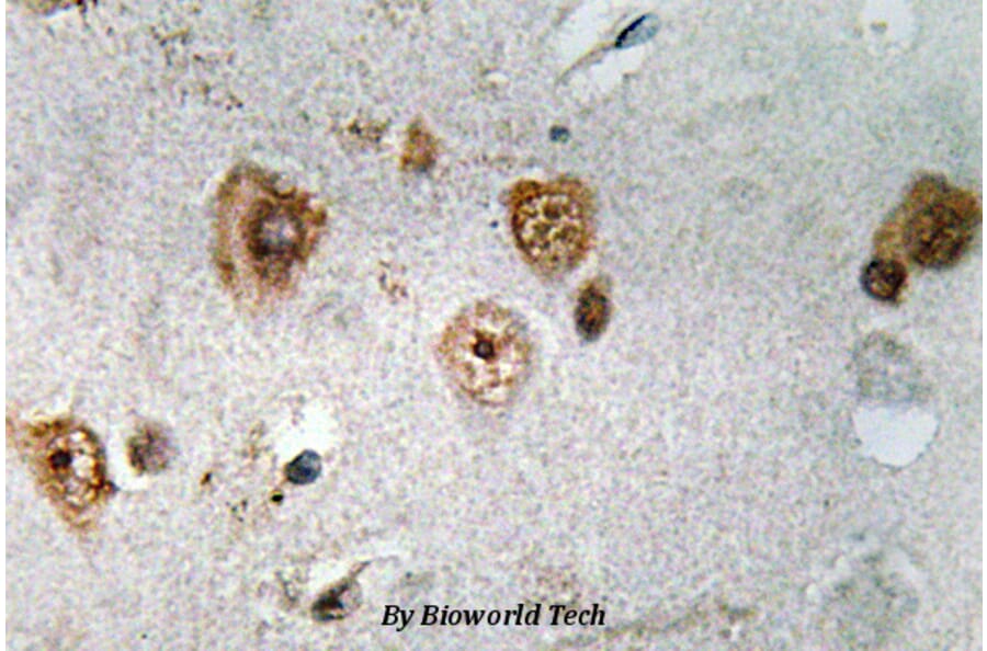 Anti-NCoA-3 (S587) Antibody from Bioworld Technology (BS3516) - Antibodies.com