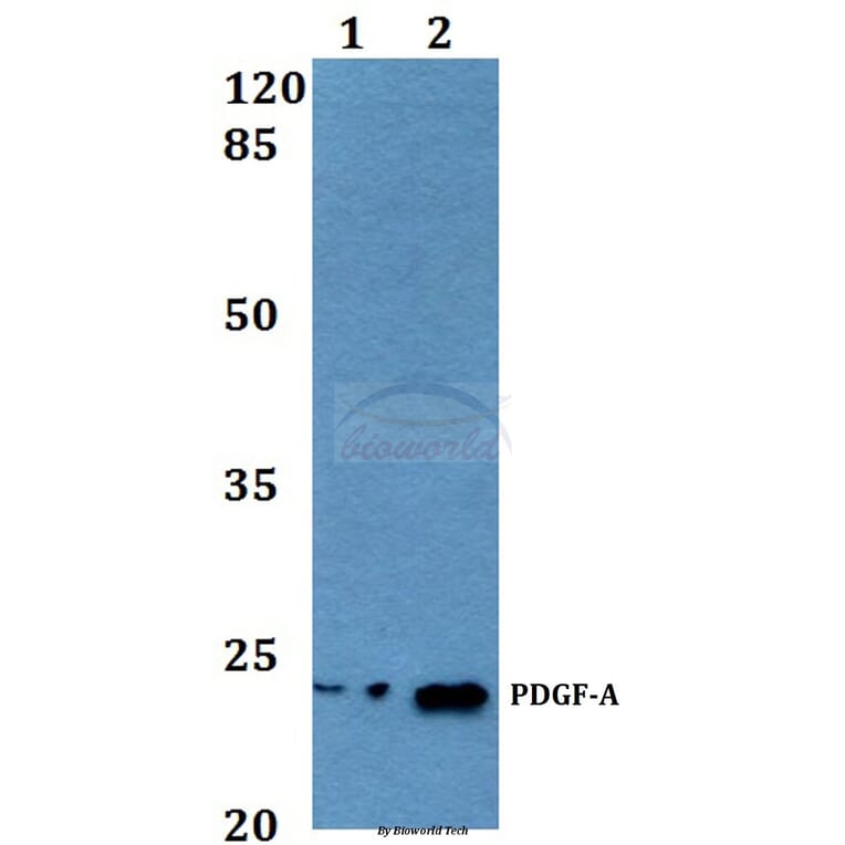 Anti-PDGF-A (K154) Antibody from Bioworld Technology (BS3517) - Antibodies.com