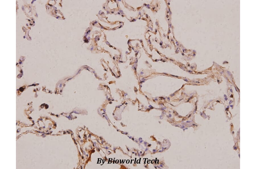 Anti-PDGF-A (K154) Antibody from Bioworld Technology (BS3517) - Antibodies.com