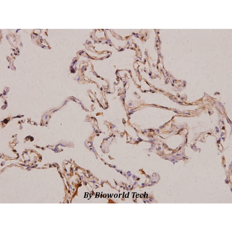 Anti-PDGF-A (K154) Antibody from Bioworld Technology (BS3517) - Antibodies.com