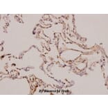 Anti-PDGF-A (K154) Antibody from Bioworld Technology (BS3517) - Antibodies.com