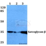 Anti-Sarcoglycan-β (V136) Antibody from Bioworld Technology (BS3518) - Antibodies.com