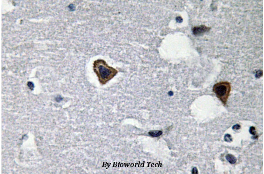Anti-Sarcoglycan-β (V136) Antibody from Bioworld Technology (BS3518) - Antibodies.com