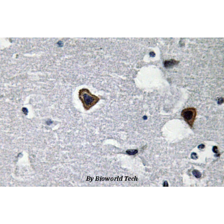 Anti-Sarcoglycan-β (V136) Antibody from Bioworld Technology (BS3518) - Antibodies.com