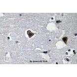 Anti-Sarcoglycan-β (V136) Antibody from Bioworld Technology (BS3518) - Antibodies.com