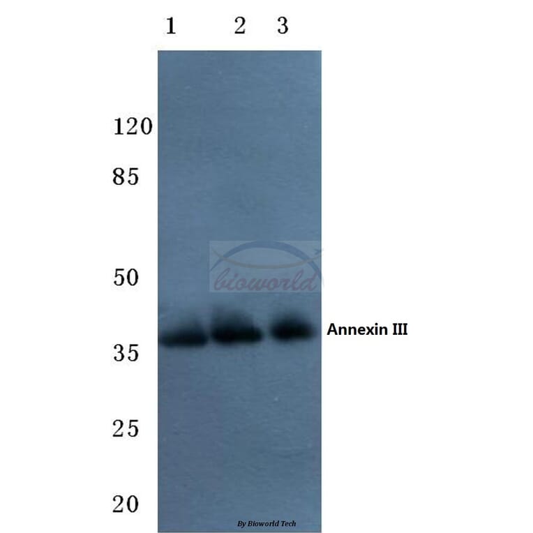 Anti-Annexin III (Y64) Antibody from Bioworld Technology (BS3519) - Antibodies.com