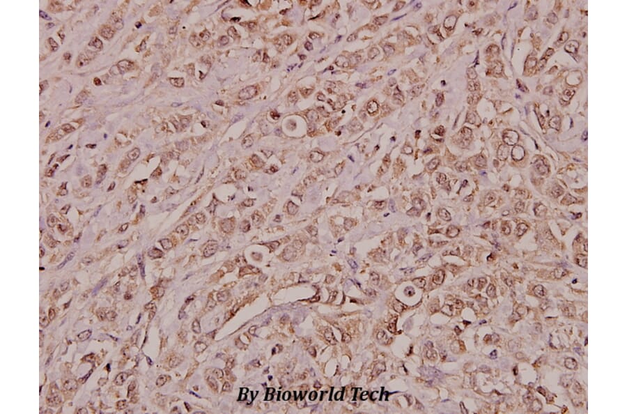 Anti-Annexin III (Y64) Antibody from Bioworld Technology (BS3519) - Antibodies.com