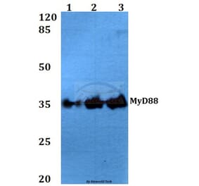Anti-MyD88 (V220) Antibody from Bioworld Technology (BS3521) - Antibodies.com