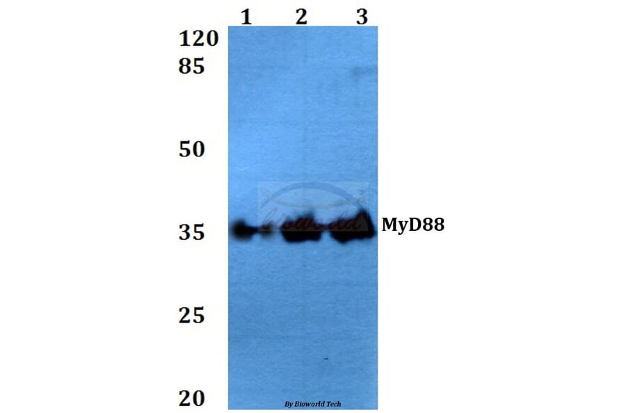 Anti-MyD88 (V220) Antibody from Bioworld Technology (BS3521) - Antibodies.com