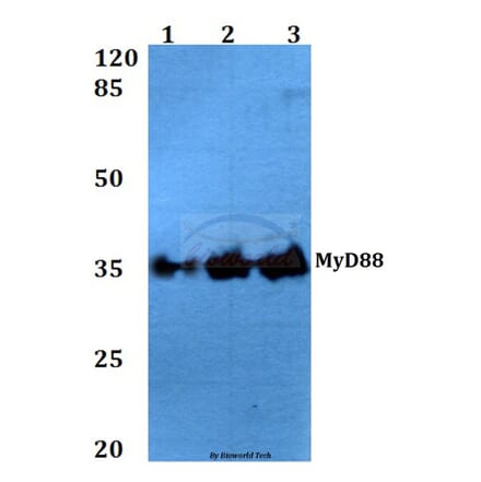 Anti-MyD88 (V220) Antibody from Bioworld Technology (BS3521) - Antibodies.com