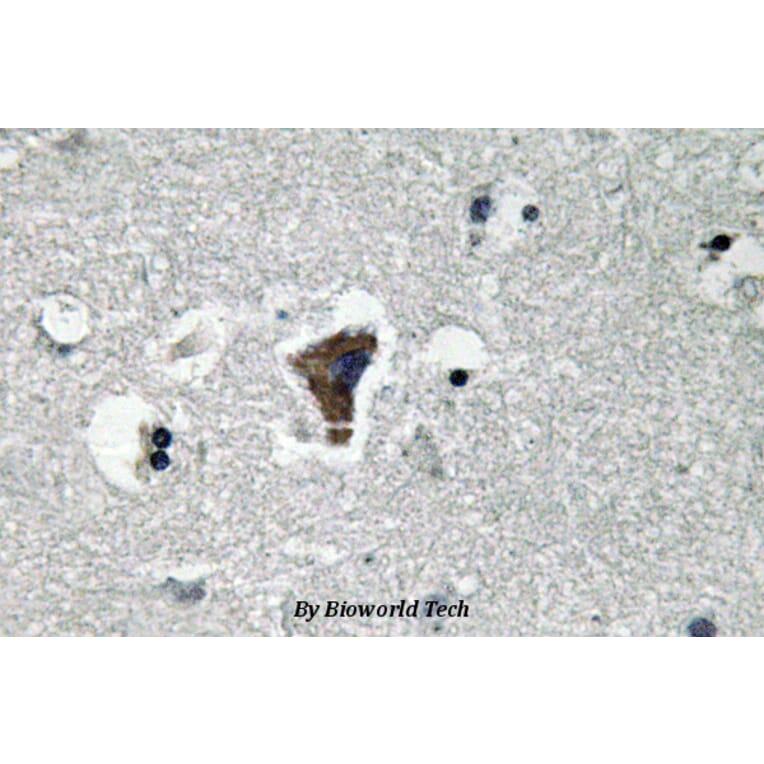 Anti-MyD88 (V220) Antibody from Bioworld Technology (BS3521) - Antibodies.com