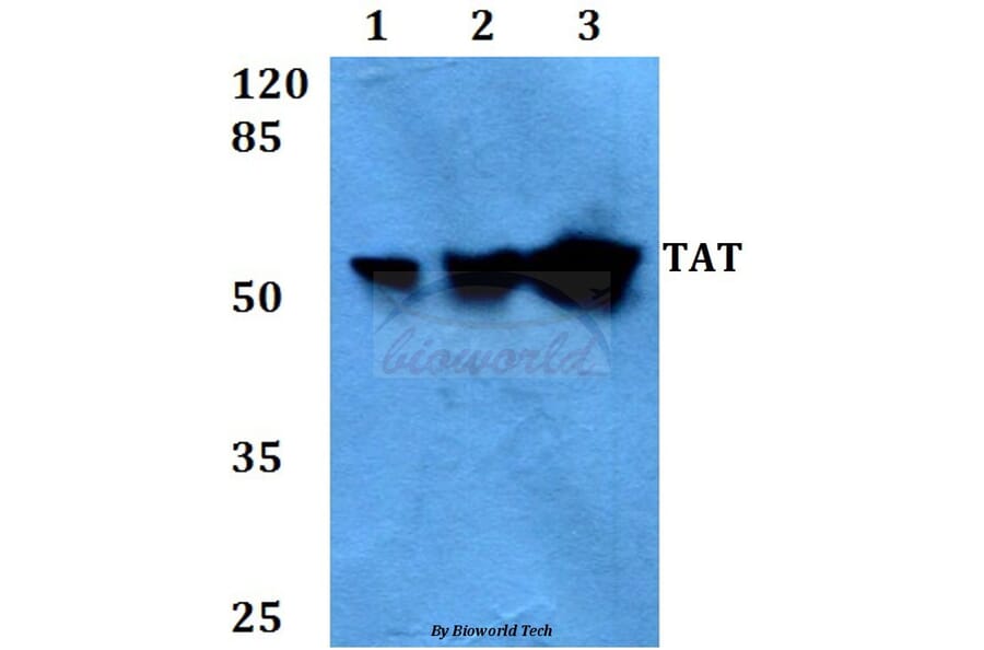 Anti-TAT (E304) Antibody from Bioworld Technology (BS3522) - Antibodies.com