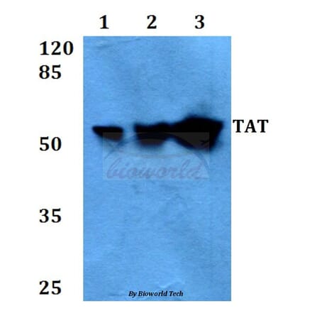 Anti-TAT (E304) Antibody from Bioworld Technology (BS3522) - Antibodies.com