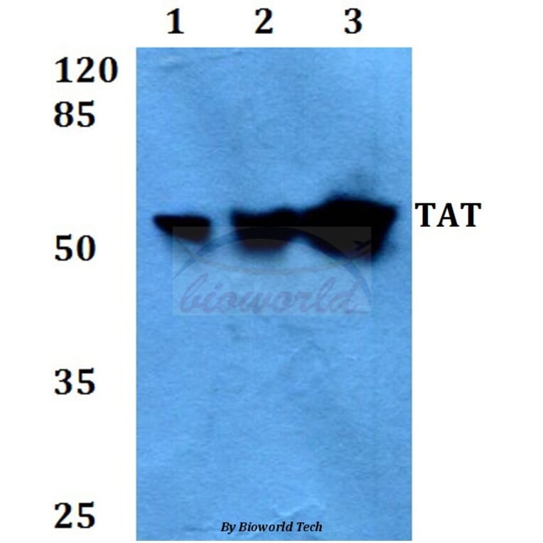 Anti-TAT (E304) Antibody from Bioworld Technology (BS3522) - Antibodies.com
