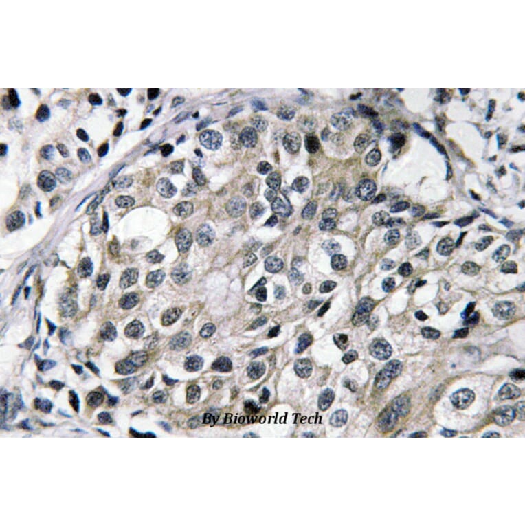 Anti-TAT (E304) Antibody from Bioworld Technology (BS3522) - Antibodies.com
