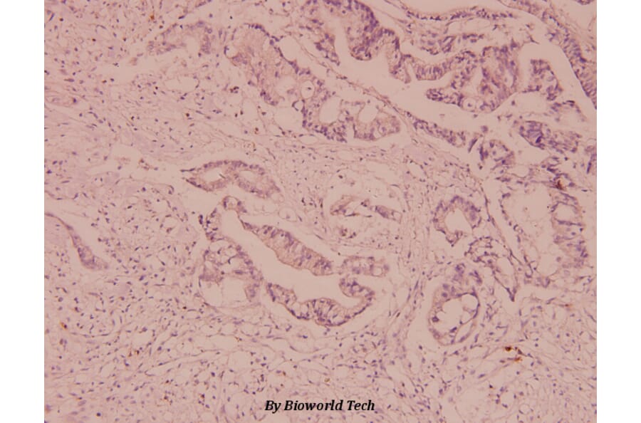 Anti-Mdr-1 (I583) Antibody from Bioworld Technology (BS3523) - Antibodies.com