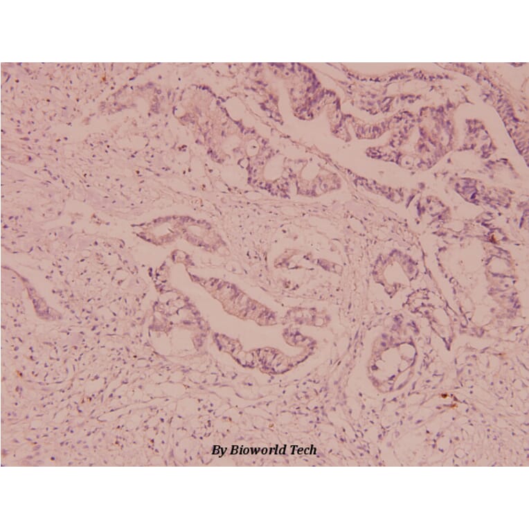 Anti-Mdr-1 (I583) Antibody from Bioworld Technology (BS3523) - Antibodies.com