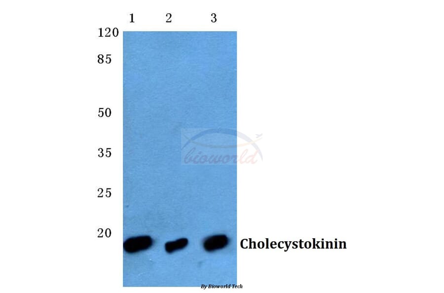 Anti-CCK (V46) Antibody from Bioworld Technology (BS3525) - Antibodies.com