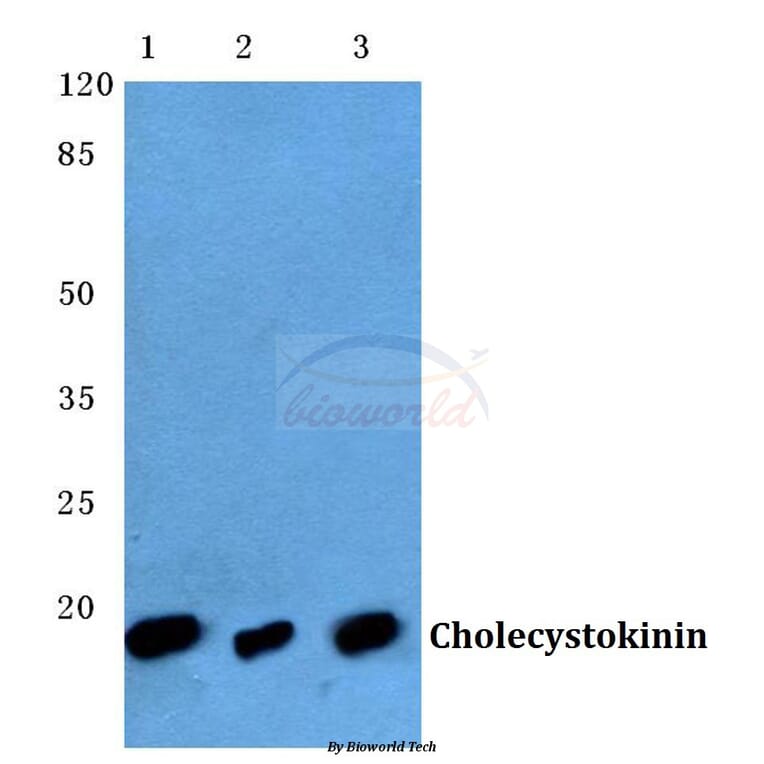 Anti-CCK (V46) Antibody from Bioworld Technology (BS3525) - Antibodies.com