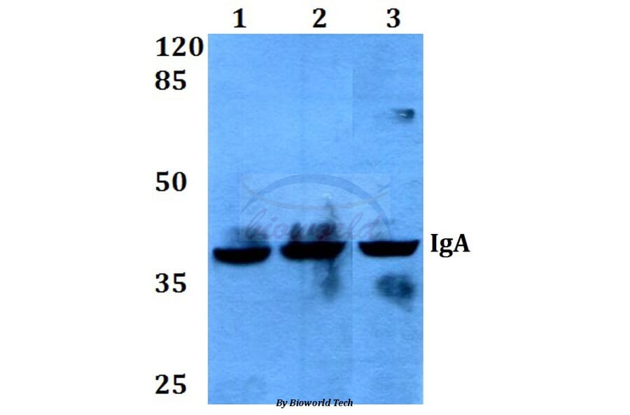 Anti-IgA (Y276) Antibody from Bioworld Technology (BS3526) - Antibodies.com