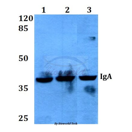 Anti-IgA (Y276) Antibody from Bioworld Technology (BS3526) - Antibodies.com