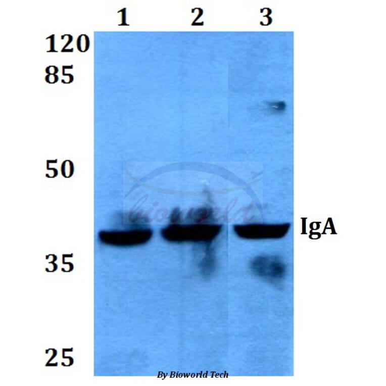 Anti-IgA (Y276) Antibody from Bioworld Technology (BS3526) - Antibodies.com