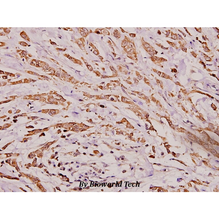 Anti-IgA (Y276) Antibody from Bioworld Technology (BS3526) - Antibodies.com