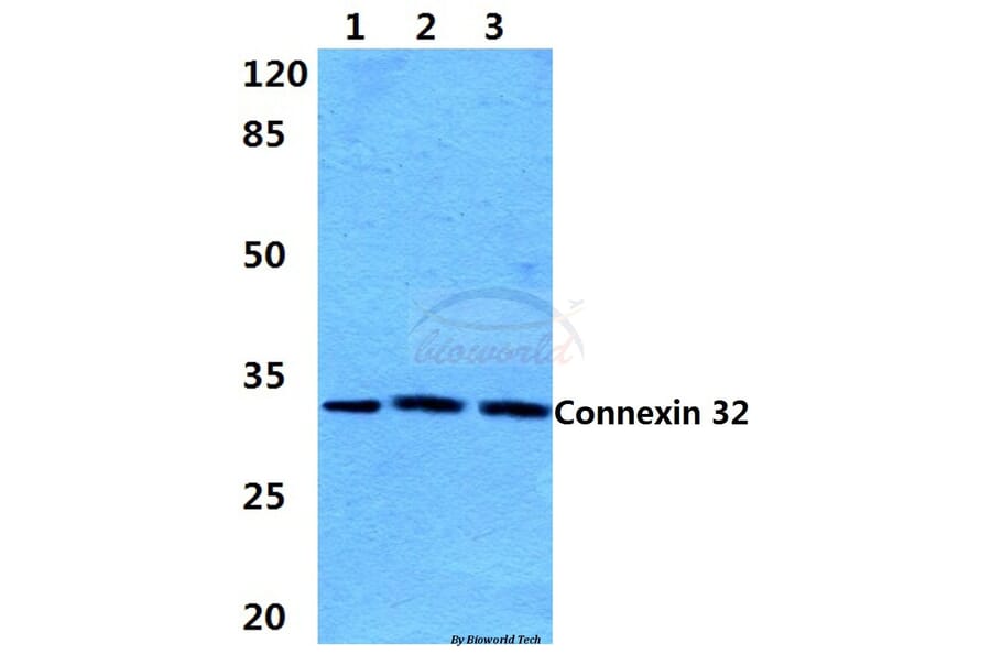 Anti-Connexin 32 (L115) Antibody from Bioworld Technology (BS3527) - Antibodies.com