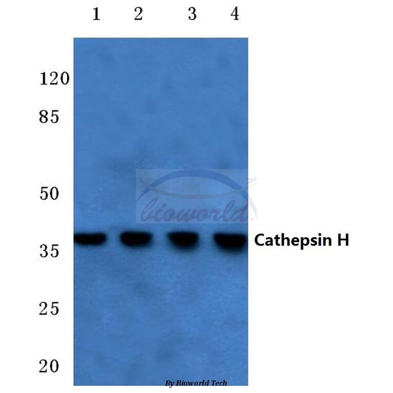 Anti-Cathepsin H (Y205) Antibody from Bioworld Technology (BS3530) - Antibodies.com