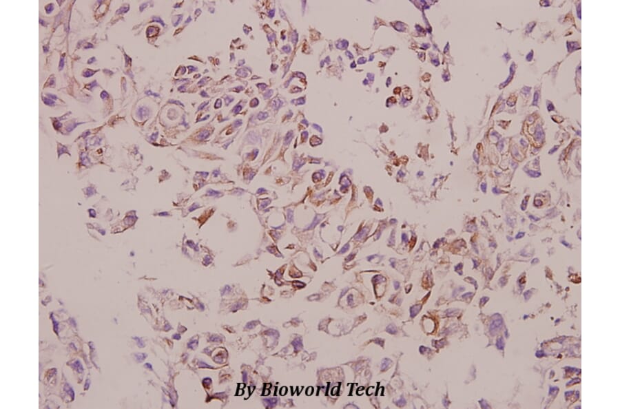 Anti-Cathepsin H (Y205) Antibody from Bioworld Technology (BS3530) - Antibodies.com