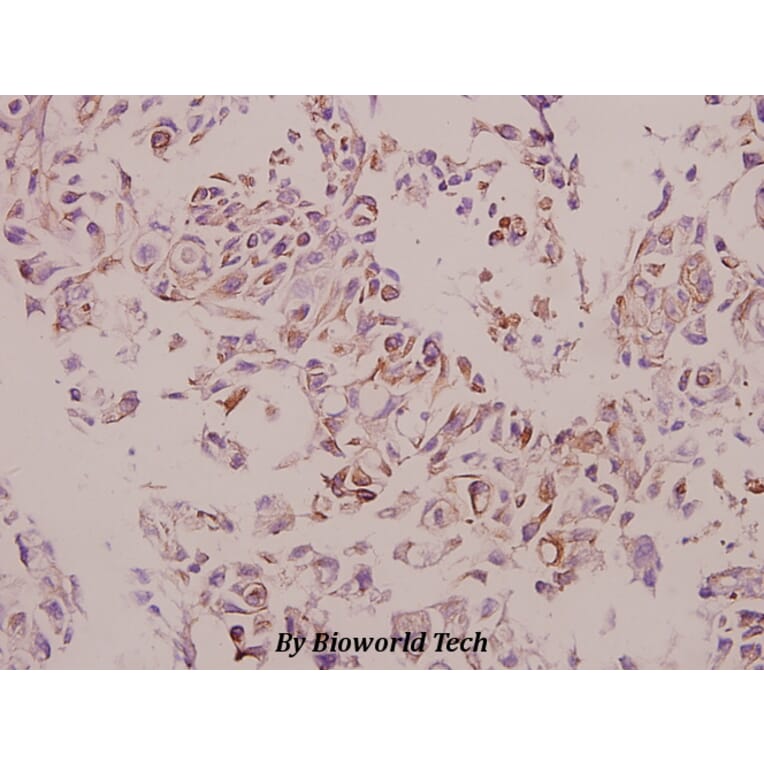 Anti-Cathepsin H (Y205) Antibody from Bioworld Technology (BS3530) - Antibodies.com
