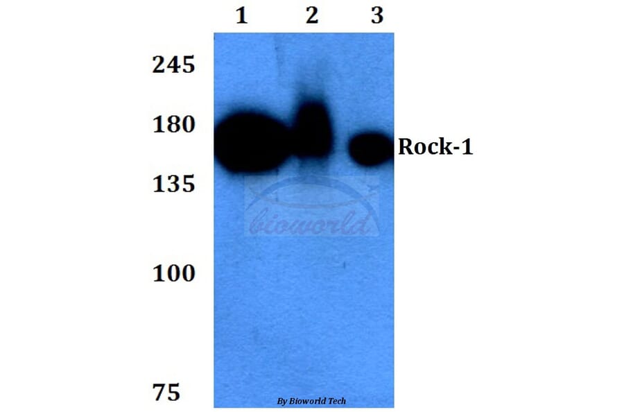 Anti-Rock-1 (N311) Antibody from Bioworld Technology (BS3537) - Antibodies.com