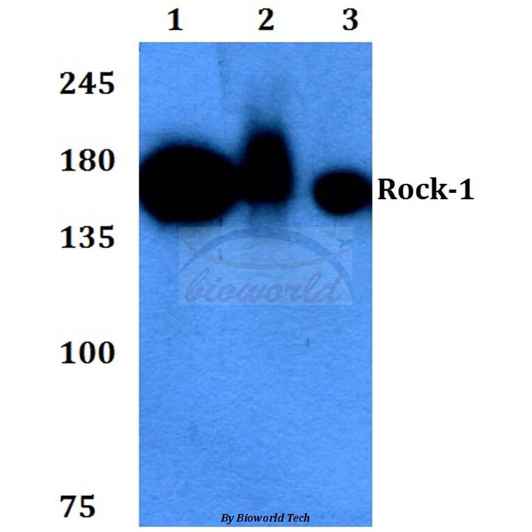 Anti-Rock-1 (N311) Antibody from Bioworld Technology (BS3537) - Antibodies.com