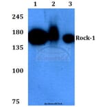 Anti-Rock-1 (N311) Antibody from Bioworld Technology (BS3537) - Antibodies.com