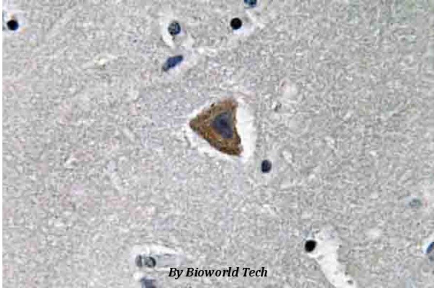 Anti-Rock-1 (N311) Antibody from Bioworld Technology (BS3537) - Antibodies.com