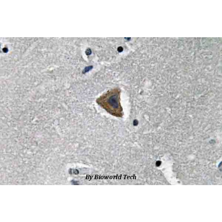 Anti-Rock-1 (N311) Antibody from Bioworld Technology (BS3537) - Antibodies.com