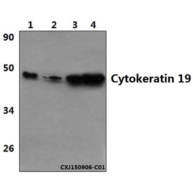 Anti-Cytokeratin 19 (L349) Antibody from Bioworld Technology (BS3540) - Antibodies.com