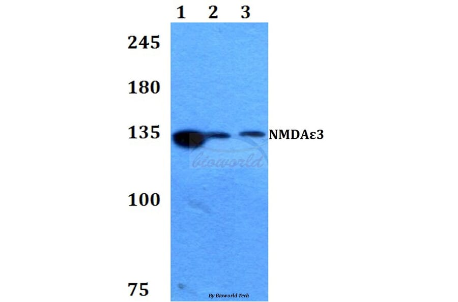 Anti-NMDAε3 (P986) Antibody from Bioworld Technology (BS3541) - Antibodies.com