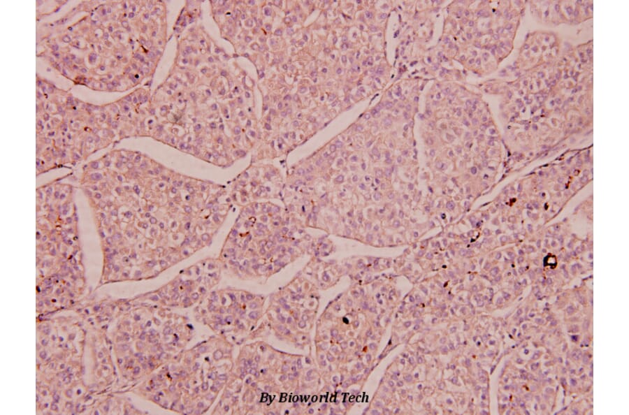 Anti-NMDAε3 (P986) Antibody from Bioworld Technology (BS3541) - Antibodies.com
