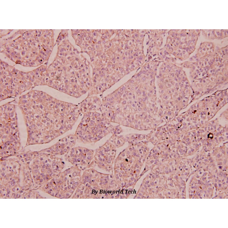 Anti-NMDAε3 (P986) Antibody from Bioworld Technology (BS3541) - Antibodies.com