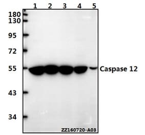 Anti-Caspase 12 (P99) Antibody from Bioworld Technology (BS3542) - Antibodies.com