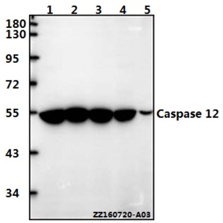 Anti-Caspase 12 (P99) Antibody from Bioworld Technology (BS3542) - Antibodies.com