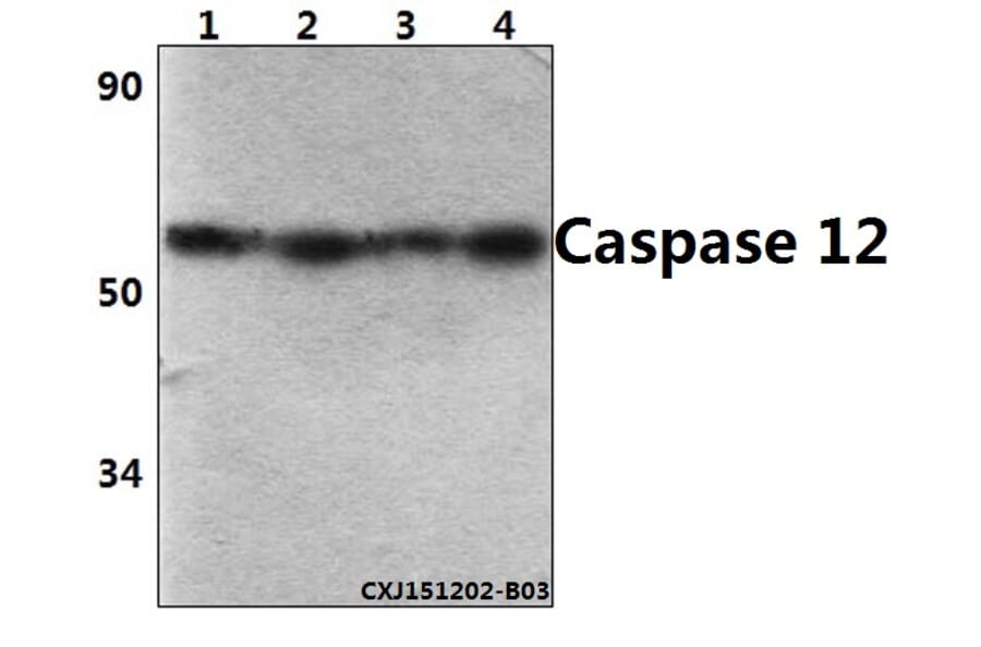 Anti-Caspase 12 (P99) Antibody from Bioworld Technology (BS3542) - Antibodies.com