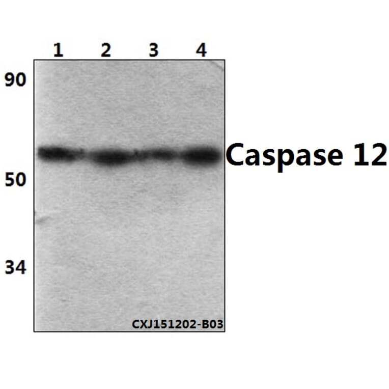 Anti-Caspase 12 (P99) Antibody from Bioworld Technology (BS3542) - Antibodies.com