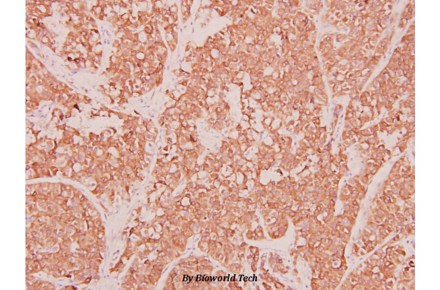 Anti-MIP-1α (D75) Antibody from Bioworld Technology (BS3543) - Antibodies.com