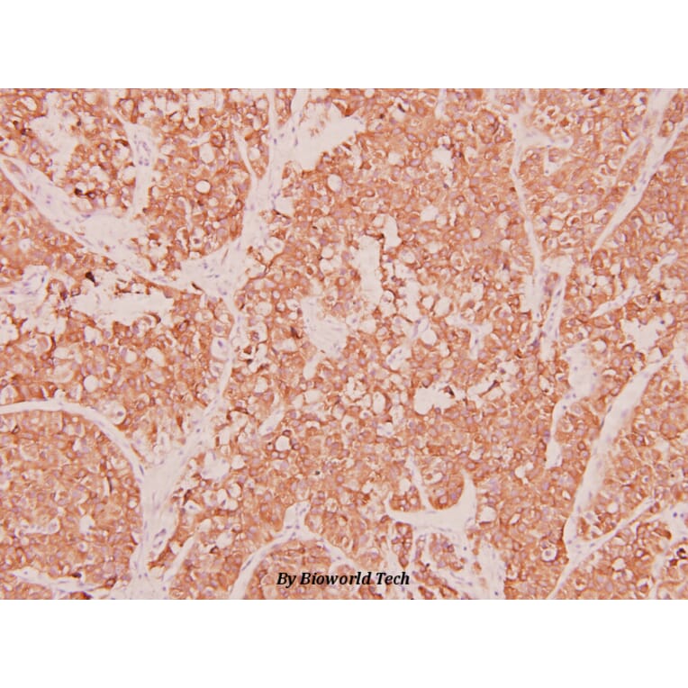 Anti-MIP-1α (D75) Antibody from Bioworld Technology (BS3543) - Antibodies.com