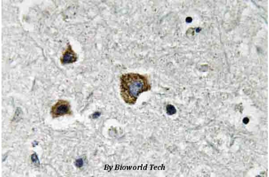 Anti-BNIP-3 (E96) Antibody from Bioworld Technology (BS3545) - Antibodies.com