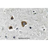 Anti-BNIP-3 (E96) Antibody from Bioworld Technology (BS3545) - Antibodies.com